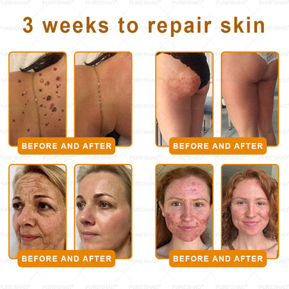 PureShade® has a surprise upgrade just for you! You've already got an amazing offer but now you've unlocked an even better one:You'll get a massive 50% off your next purchase - for the next two minutes only!