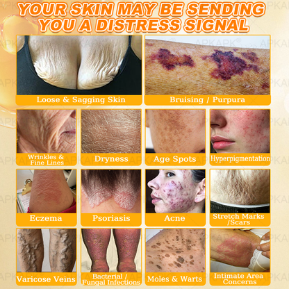 Made and Shipped from USA 🎉𝖠𝖯𝖪𝖠𝖯𝖪® 𝖡𝖾𝖾 𝗏𝖾𝗇𝗈𝗆 𝖲𝗄𝗂𝗇 𝖱𝖾𝗌𝗍𝗈𝗋𝖺𝗍𝗂𝗈𝗇 𝖢𝗋𝖾𝖺𝗆