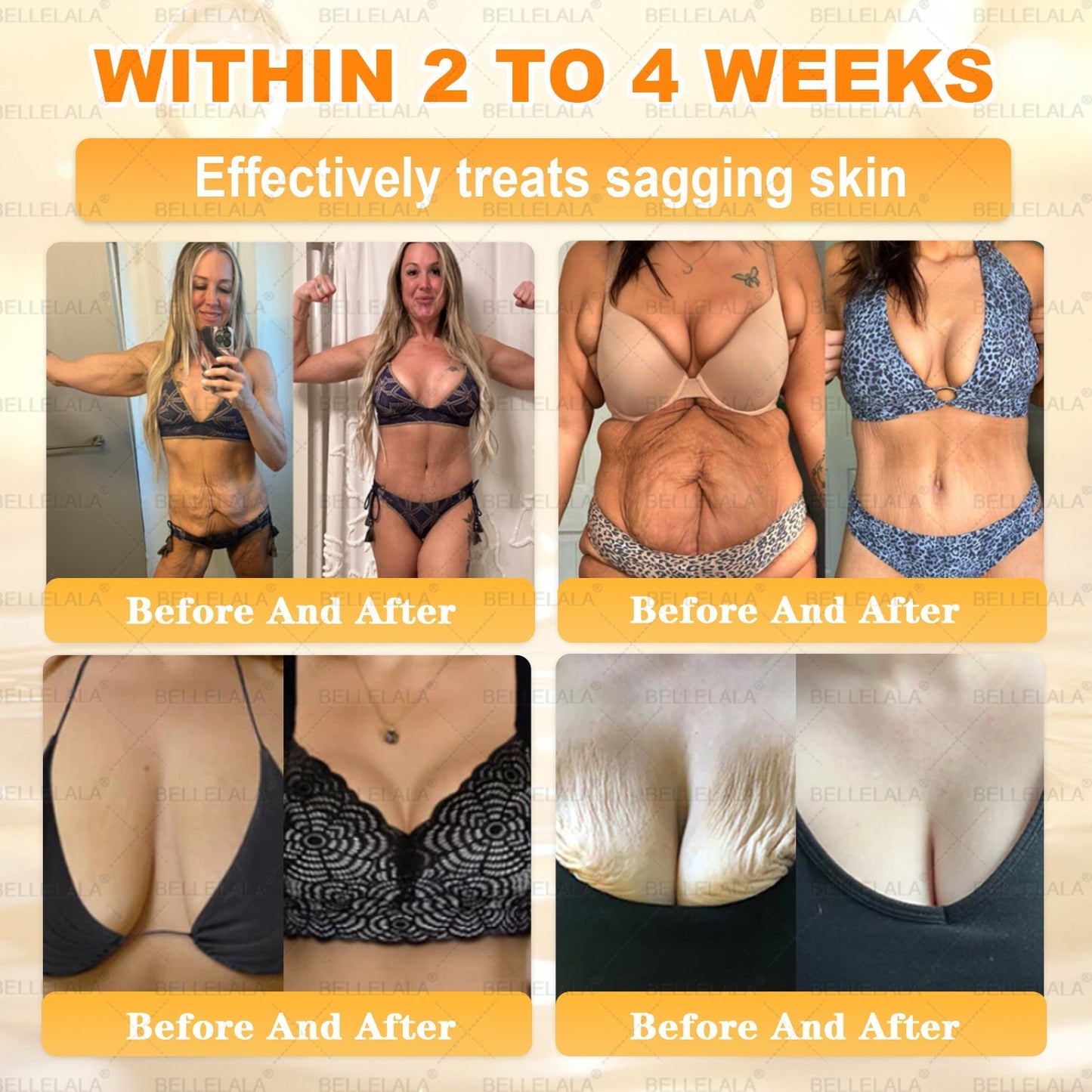 𝐁𝐞𝐥𝐥𝐞𝐥𝐚𝐥𝐚® 𝐁𝐞𝐞 𝐯𝐞𝐧𝐨𝐦 𝐒𝐤𝐢𝐧 𝐑𝐞𝐬𝐭𝐨𝐫𝐚𝐭𝐢𝐨𝐧 𝐂𝐫𝐞𝐚𝐦