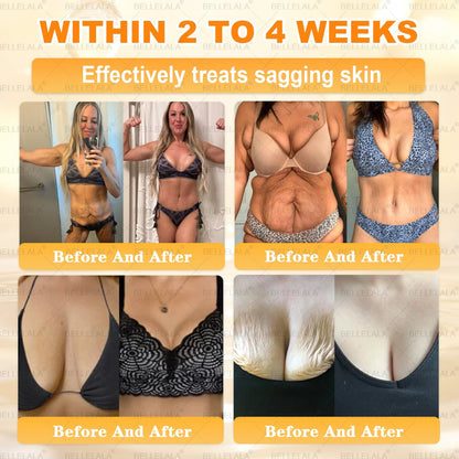 𝐁𝐞𝐥𝐥𝐞𝐥𝐚𝐥𝐚® 𝐁𝐞𝐞 𝐯𝐞𝐧𝐨𝐦 𝐒𝐤𝐢𝐧 𝐑𝐞𝐬𝐭𝐨𝐫𝐚𝐭𝐢𝐨𝐧 𝐂𝐫𝐞𝐚𝐦