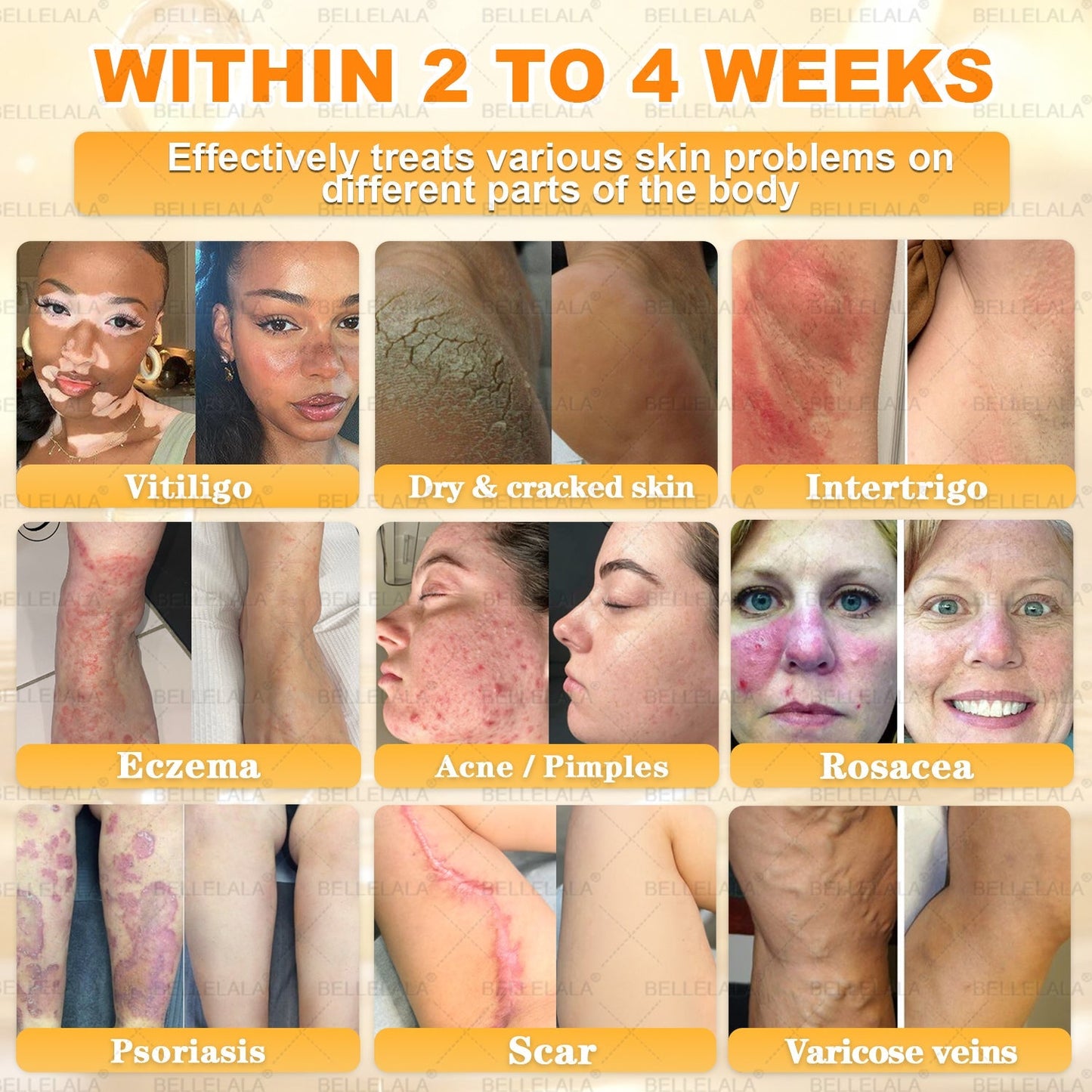 𝐁𝐞𝐥𝐥𝐞𝐥𝐚𝐥𝐚® 𝐁𝐞𝐞 𝐯𝐞𝐧𝐨𝐦 𝐒𝐤𝐢𝐧 𝐑𝐞𝐬𝐭𝐨𝐫𝐚𝐭𝐢𝐨𝐧 𝐂𝐫𝐞𝐚𝐦