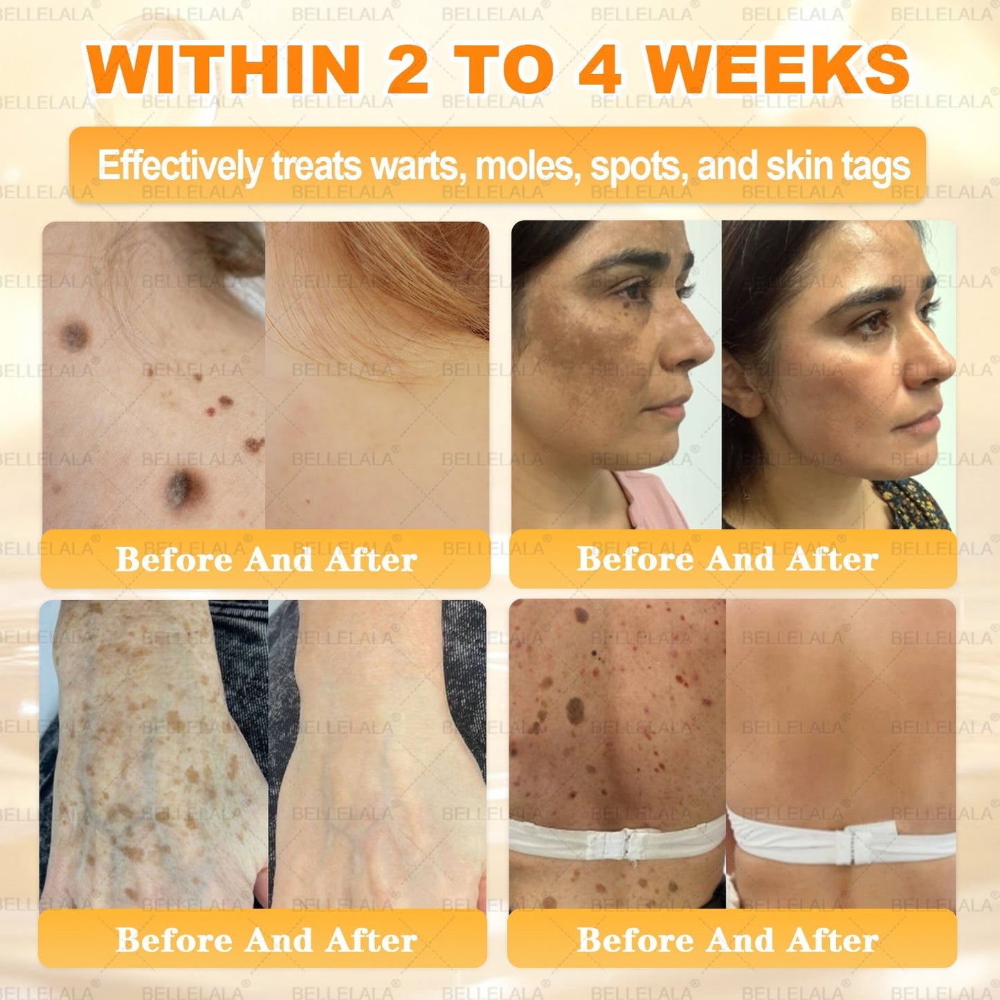 𝐁𝐞𝐥𝐥𝐞𝐥𝐚𝐥𝐚® 𝐁𝐞𝐞 𝐯𝐞𝐧𝐨𝐦 𝐒𝐤𝐢𝐧 𝐑𝐞𝐬𝐭𝐨𝐫𝐚𝐭𝐢𝐨𝐧 𝐂𝐫𝐞𝐚𝐦