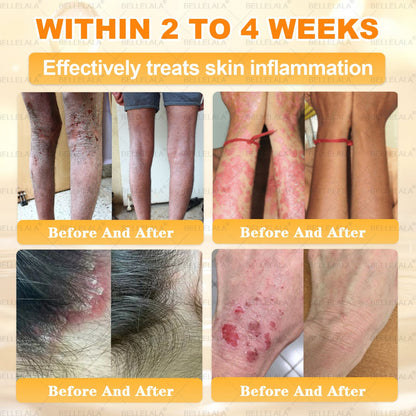 𝐁𝐞𝐥𝐥𝐞𝐥𝐚𝐥𝐚® 𝐁𝐞𝐞 𝐯𝐞𝐧𝐨𝐦 𝐒𝐤𝐢𝐧 𝐑𝐞𝐬𝐭𝐨𝐫𝐚𝐭𝐢𝐨𝐧 𝐂𝐫𝐞𝐚𝐦