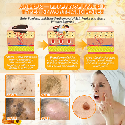 𝐁𝐞𝐥𝐥𝐞𝐥𝐚𝐥𝐚® 𝐁𝐞𝐞 𝐯𝐞𝐧𝐨𝐦 𝐒𝐤𝐢𝐧 𝐑𝐞𝐬𝐭𝐨𝐫𝐚𝐭𝐢𝐨𝐧 𝐂𝐫𝐞𝐚𝐦