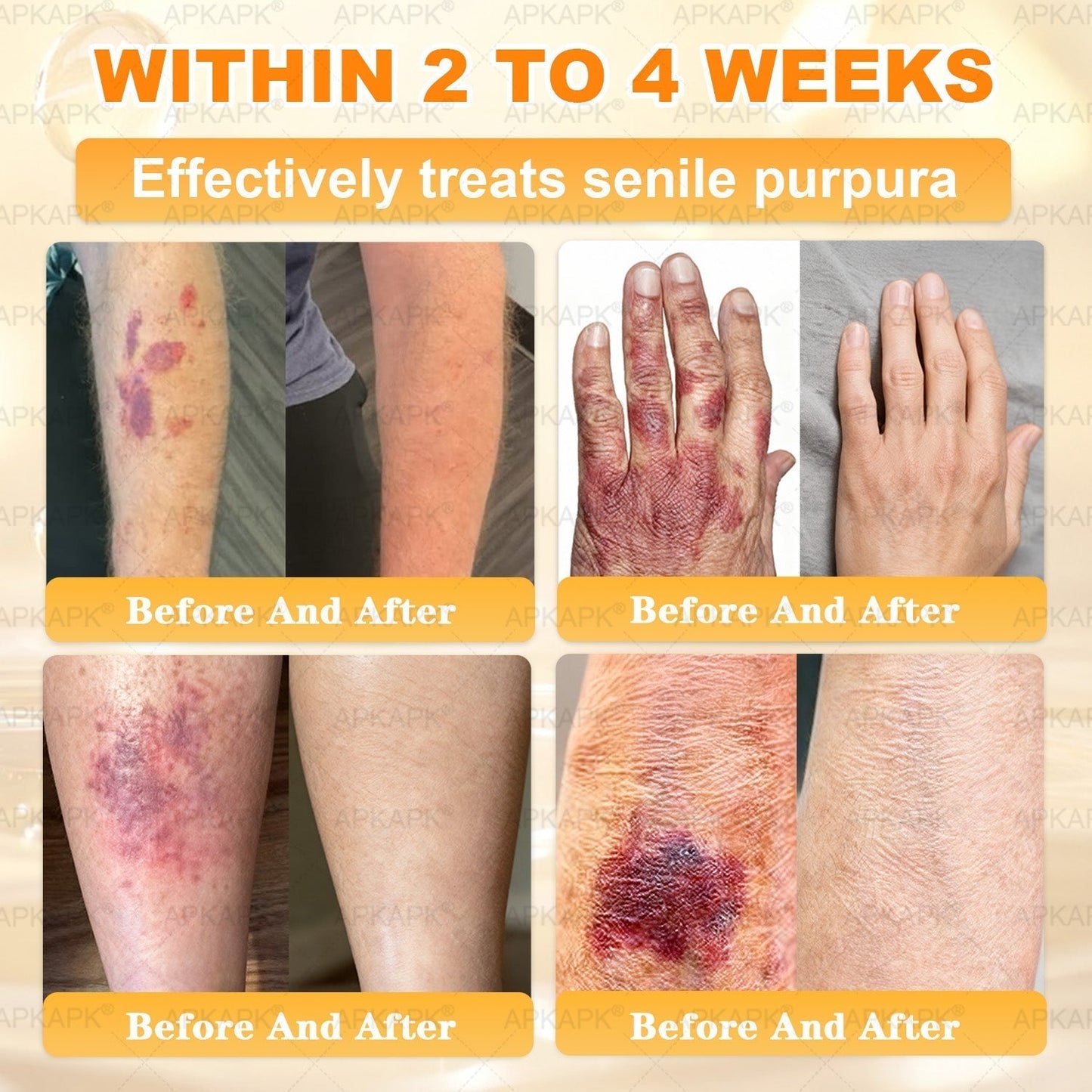 Made and Shipped from USA 🎉𝖠𝖯𝖪𝖠𝖯𝖪® 𝖡𝖾𝖾 𝗏𝖾𝗇𝗈𝗆 𝖲𝗄𝗂𝗇 𝖱𝖾𝗌𝗍𝗈𝗋𝖺𝗍𝗂𝗈𝗇 𝖢𝗋𝖾𝖺𝗆