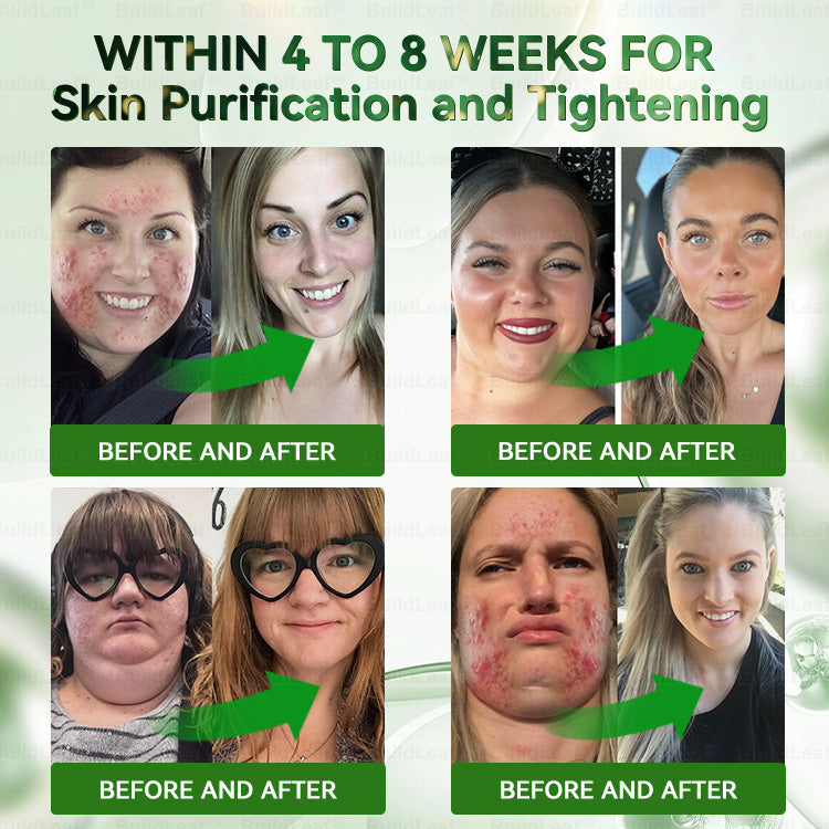 𝑩𝒖𝒊𝒍𝒅𝑳𝒆𝒂𝒇® 𝑮𝑳𝑷-1 7-𝑫𝒂𝒚 𝑮𝒖𝒕 𝑪𝒍𝒆𝒂𝒏𝒔𝒆 & 𝑺𝒍𝒊𝒎 𝑺𝒖𝒑𝒑𝒐𝒓𝒕 𝑶𝒓𝒂𝒍 𝑺𝒐𝒍𝒖𝒕𝒊𝒐𝒏 – 𝑵𝒂𝒕𝒖𝒓𝒂𝒍 𝑫𝒆𝒕𝒐𝒙 & 𝑫𝒊𝒈𝒆𝒔𝒕𝒊𝒗𝒆 𝑯𝒆𝒂𝒍𝒕𝒉 𝑺𝒖𝒑𝒆𝒓𝒇𝒐𝒐𝒅 𝒇𝒐𝒓 𝑾𝒆𝒊𝒈𝒉𝒕 𝑪𝒐𝒏𝒕𝒓𝒐𝒍, 𝑴𝒆𝒏𝒕𝒂𝒍 𝑪𝒍𝒂𝒓𝒊𝒕𝒚, 𝑪𝒂𝒓𝒅𝒊𝒐𝒗𝒂𝒔𝒄𝒖𝒍𝒂𝒓 & 𝑱𝒐𝒊𝒏𝒕 𝑾𝒆𝒍𝒍𝒏𝒆𝒔𝒔, 𝑺𝒌𝒊𝒏 𝑭𝒊𝒓𝒎𝒊𝒏𝒈, 𝑨𝒏𝒕𝒊-𝑨𝒈𝒊𝒏𝒈, 𝑬𝒏𝒆𝒓𝒈𝒚 𝑩𝒐𝒐𝒔𝒕 & 𝑭𝒂𝒍𝒍-𝑾𝒊𝒏𝒕𝒆𝒓 𝑰𝒎𝒎𝒖𝒏𝒆 𝑺𝒖𝒑𝒑𝒐𝒓𝒕