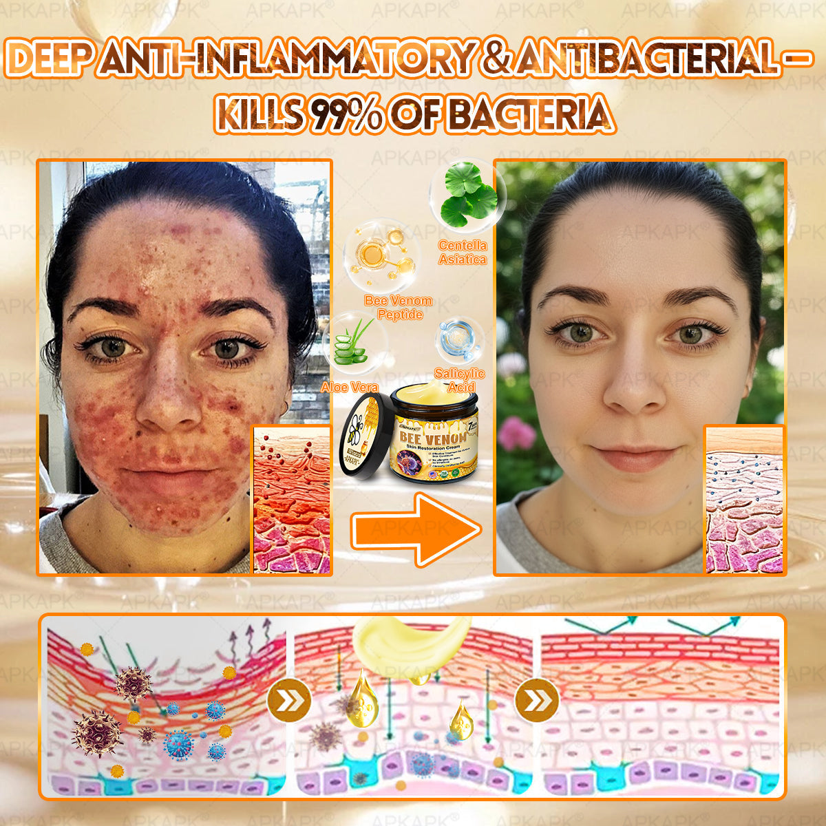 Made and Shipped from USA 🎉𝖠𝖯𝖪𝖠𝖯𝖪® 𝖡𝖾𝖾 𝗏𝖾𝗇𝗈𝗆 𝖲𝗄𝗂𝗇 𝖱𝖾𝗌𝗍𝗈𝗋𝖺𝗍𝗂𝗈𝗇 𝖢𝗋𝖾𝖺𝗆