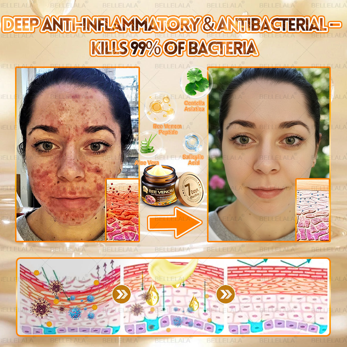 𝐁𝐞𝐥𝐥𝐞𝐥𝐚𝐥𝐚® 𝐁𝐞𝐞 𝐯𝐞𝐧𝐨𝐦 𝐒𝐤𝐢𝐧 𝐑𝐞𝐬𝐭𝐨𝐫𝐚𝐭𝐢𝐨𝐧 𝐂𝐫𝐞𝐚𝐦